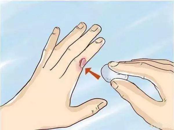 春季皮肤病高发,止痒消肿