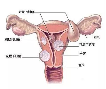 【<a href=http://www.jiaboshia.com/demo2.html target=_blank class=infotextkey>加博士</a>医嘱】湿气太重,女人太累,而且危害无穷