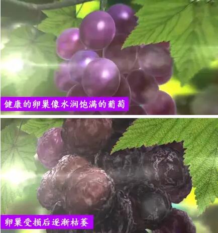 早衰!不孕!更年期提前! 卵巢囊肿手术对卵巢功能影响多多